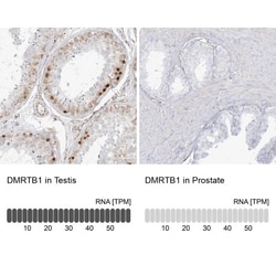 DMRTB1 Antibody, Novus Biologicals:Antibodies:Primary Antibodies